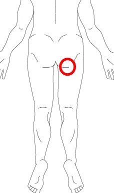 痛い 足 生理 前 の 付け根